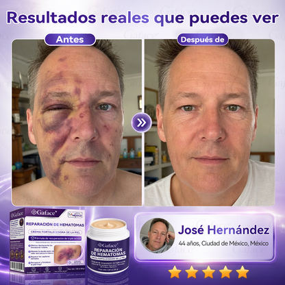 ✨👍【¡𝑴á𝒔 𝒅𝒆 110 𝒎𝒊𝒍 𝒗𝒆𝒏𝒅𝒊𝒅𝒐𝒔!】✨ 𝑮𝒂𝒇𝒂𝒄𝒆® 𝑪𝒓𝒆𝒎𝒂 𝑹𝒆𝒑𝒂𝒓𝒂𝒅𝒐𝒓𝒂 𝒅𝒆 𝑯𝒆𝒎𝒂𝒕𝒐𝒎𝒂𝒔 𝒚 𝑭𝒐𝒓𝒕𝒂𝒍𝒆𝒄𝒆𝒅𝒐𝒓𝒂 𝒅𝒆 𝒍𝒂 𝑷𝒊𝒆𝒍