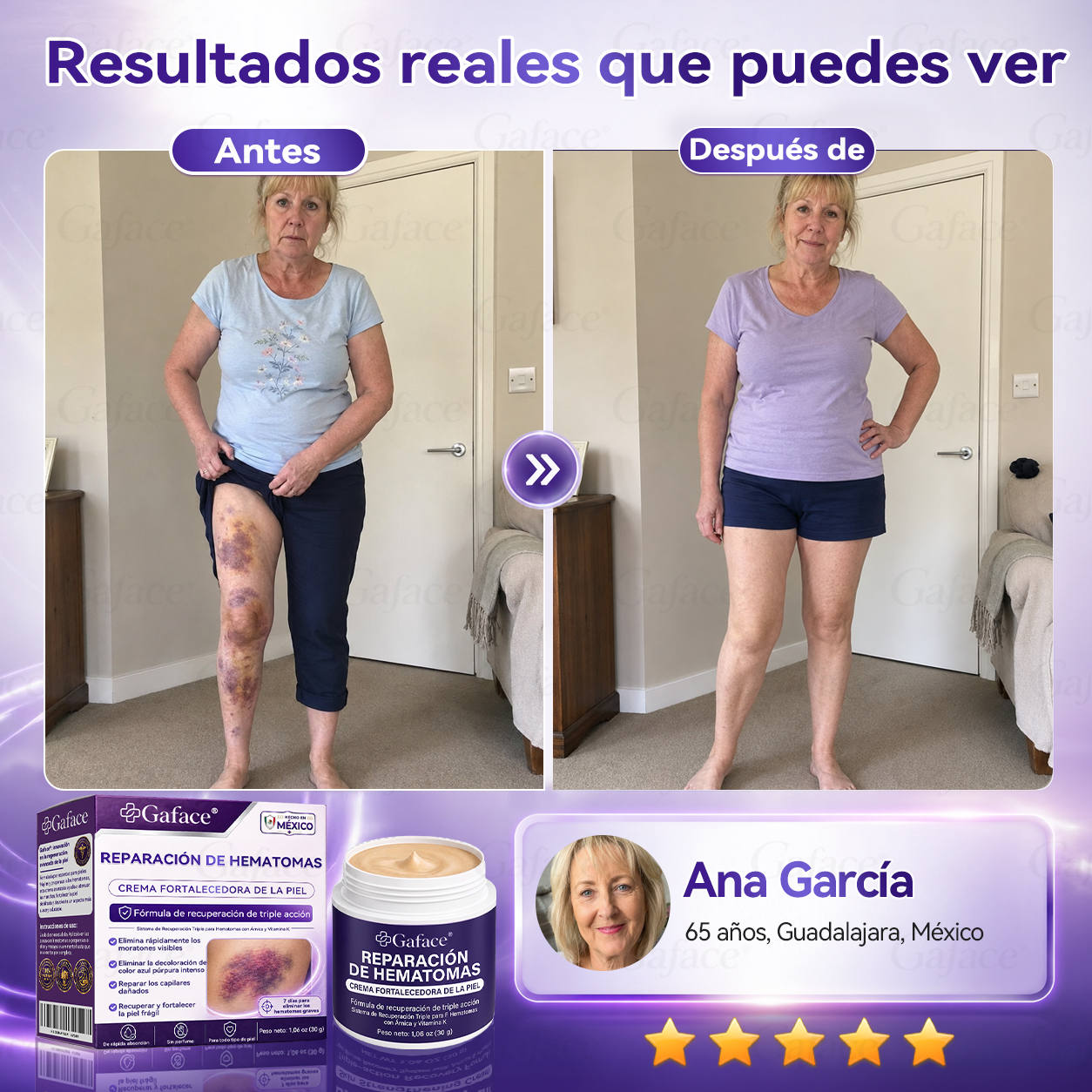 ✨👍【¡𝑴á𝒔 𝒅𝒆 110 𝒎𝒊𝒍 𝒗𝒆𝒏𝒅𝒊𝒅𝒐𝒔!】✨ 𝑮𝒂𝒇𝒂𝒄𝒆® 𝑪𝒓𝒆𝒎𝒂 𝑹𝒆𝒑𝒂𝒓𝒂𝒅𝒐𝒓𝒂 𝒅𝒆 𝑯𝒆𝒎𝒂𝒕𝒐𝒎𝒂𝒔 𝒚 𝑭𝒐𝒓𝒕𝒂𝒍𝒆𝒄𝒆𝒅𝒐𝒓𝒂 𝒅𝒆 𝒍𝒂 𝑷𝒊𝒆𝒍