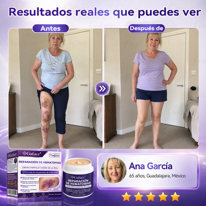 ✨👍【¡𝑴á𝒔 𝒅𝒆 110 𝒎𝒊𝒍 𝒗𝒆𝒏𝒅𝒊𝒅𝒐𝒔!】✨ 𝑮𝒂𝒇𝒂𝒄𝒆® 𝑪𝒓𝒆𝒎𝒂 𝑹𝒆𝒑𝒂𝒓𝒂𝒅𝒐𝒓𝒂 𝒅𝒆 𝑯𝒆𝒎𝒂𝒕𝒐𝒎𝒂𝒔 𝒚 𝑭𝒐𝒓𝒕𝒂𝒍𝒆𝒄𝒆𝒅𝒐𝒓𝒂 𝒅𝒆 𝒍𝒂 𝑷𝒊𝒆𝒍