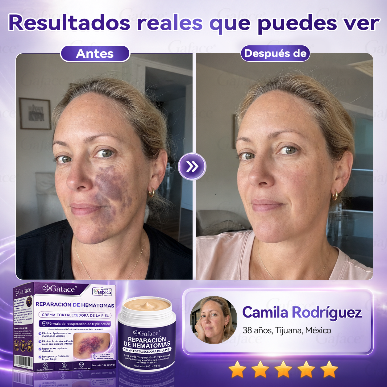 ✨👍【¡𝑴á𝒔 𝒅𝒆 110 𝒎𝒊𝒍 𝒗𝒆𝒏𝒅𝒊𝒅𝒐𝒔!】✨ 𝑮𝒂𝒇𝒂𝒄𝒆® 𝑪𝒓𝒆𝒎𝒂 𝑹𝒆𝒑𝒂𝒓𝒂𝒅𝒐𝒓𝒂 𝒅𝒆 𝑯𝒆𝒎𝒂𝒕𝒐𝒎𝒂𝒔 𝒚 𝑭𝒐𝒓𝒕𝒂𝒍𝒆𝒄𝒆𝒅𝒐𝒓𝒂 𝒅𝒆 𝒍𝒂 𝑷𝒊𝒆𝒍