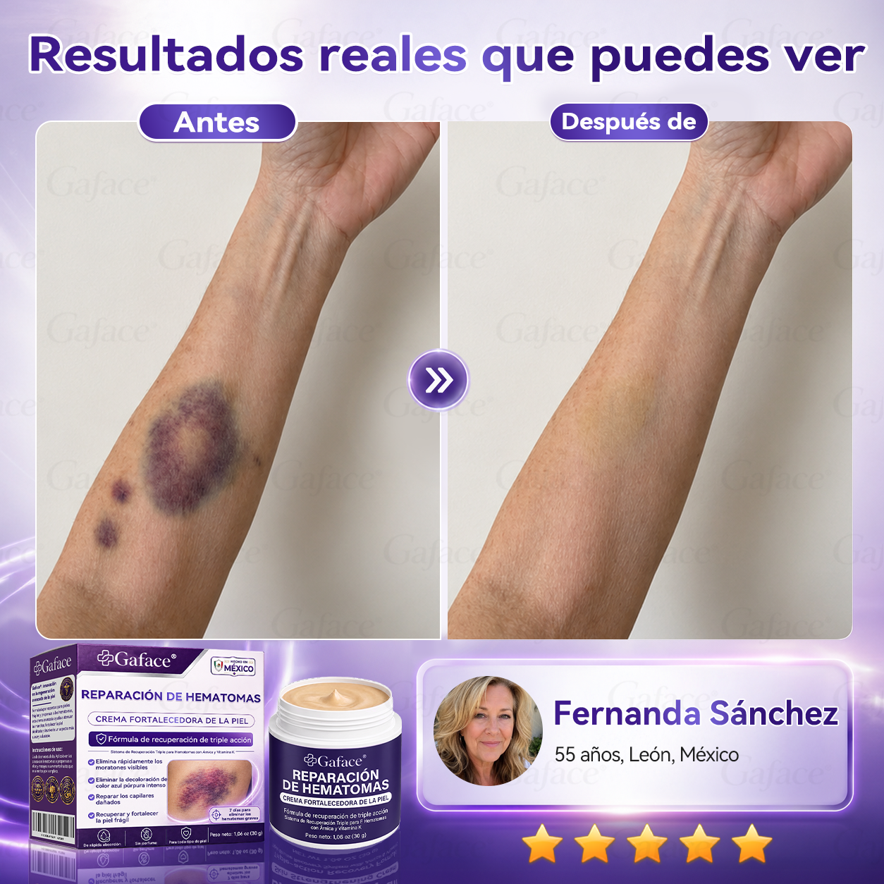 ✨👍【¡𝑴á𝒔 𝒅𝒆 110 𝒎𝒊𝒍 𝒗𝒆𝒏𝒅𝒊𝒅𝒐𝒔!】✨ 𝑮𝒂𝒇𝒂𝒄𝒆® 𝑪𝒓𝒆𝒎𝒂 𝑹𝒆𝒑𝒂𝒓𝒂𝒅𝒐𝒓𝒂 𝒅𝒆 𝑯𝒆𝒎𝒂𝒕𝒐𝒎𝒂𝒔 𝒚 𝑭𝒐𝒓𝒕𝒂𝒍𝒆𝒄𝒆𝒅𝒐𝒓𝒂 𝒅𝒆 𝒍𝒂 𝑷𝒊𝒆𝒍