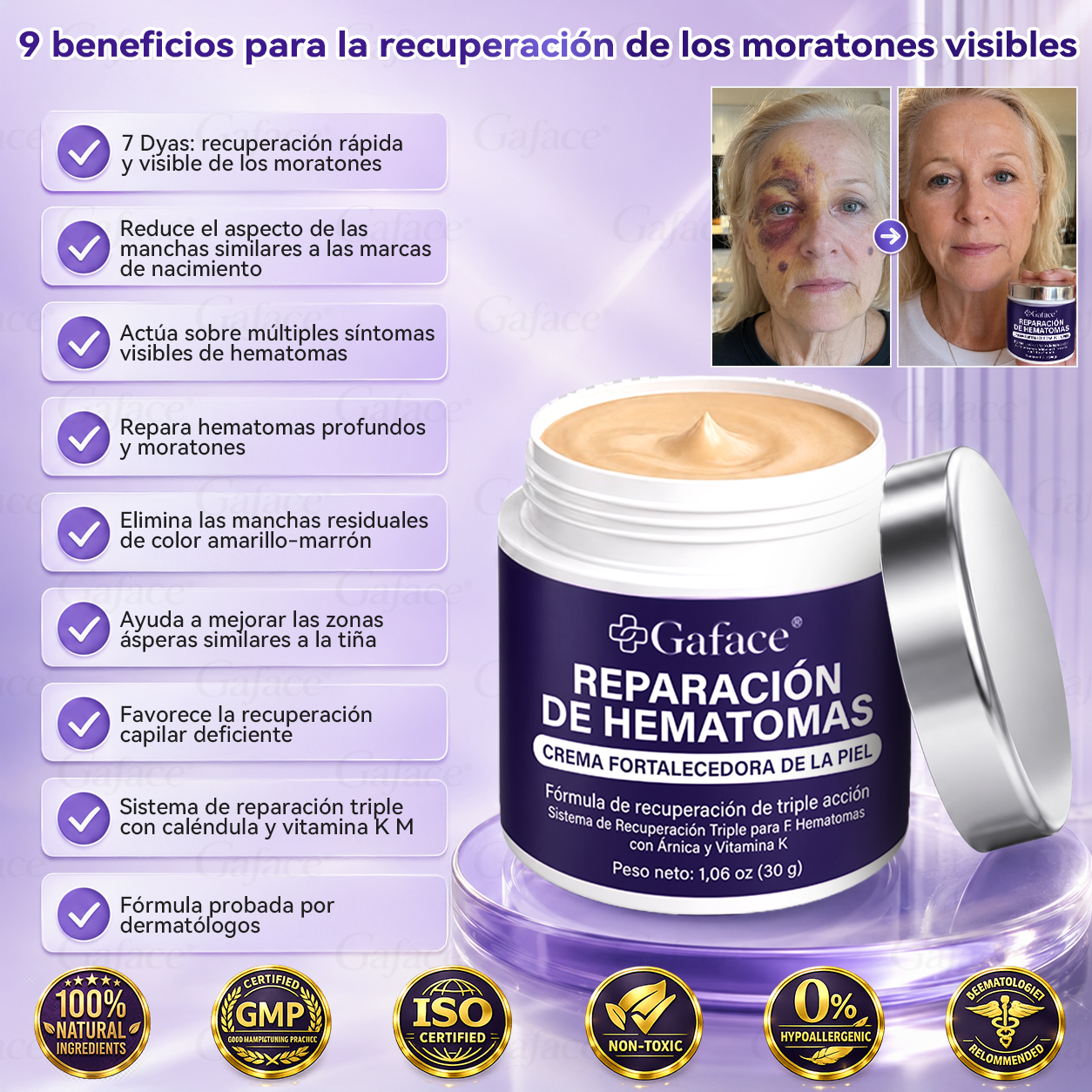 ✨👍【¡𝑴á𝒔 𝒅𝒆 110 𝒎𝒊𝒍 𝒗𝒆𝒏𝒅𝒊𝒅𝒐𝒔!】✨ 𝑮𝒂𝒇𝒂𝒄𝒆® 𝑪𝒓𝒆𝒎𝒂 𝑹𝒆𝒑𝒂𝒓𝒂𝒅𝒐𝒓𝒂 𝒅𝒆 𝑯𝒆𝒎𝒂𝒕𝒐𝒎𝒂𝒔 𝒚 𝑭𝒐𝒓𝒕𝒂𝒍𝒆𝒄𝒆𝒅𝒐𝒓𝒂 𝒅𝒆 𝒍𝒂 𝑷𝒊𝒆𝒍