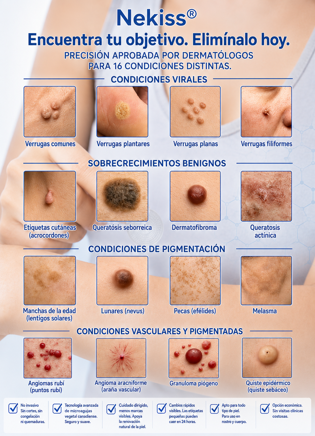 👩‍⚕️🎉𝑻𝒊𝒆𝒏𝒅𝒂 𝑶𝒇𝒊𝒄𝒊𝒂𝒍 | 𝑵𝐞𝒌𝐢𝐬𝐬® 🌿 𝑀𝑖𝑐𝑟𝑜𝑎𝑔𝑢𝑗𝑎𝑠 𝑃𝑖𝑒𝑙 𝐼𝑚𝑝𝑒𝑐𝑎𝑏𝑙𝑒 𝐸𝑙𝑖𝑚𝑖𝑛𝑎𝑐𝑖ó𝑛 𝐷𝑒 𝑉𝑒𝑟𝑟𝑢𝑔𝑎𝑠 𝑃𝑎𝑟𝑐ℎ𝑒 (𝑃𝑎𝑟𝑎 𝑎𝑐𝑟𝑜𝑐𝑜𝑟𝑑𝑜𝑛𝑒𝑠, 𝑝𝑒𝑞𝑢𝑒ñ𝑎𝑠 𝑖𝑚𝑝𝑒𝑟𝑓𝑒𝑐𝑐𝑖𝑜𝑛𝑒𝑠 𝑐𝑢𝑡á𝑛𝑒𝑎𝑠, 𝑣𝑒𝑟𝑟𝑢𝑔𝑎𝑠, 𝑙𝑢𝑛𝑎𝑟𝑒𝑠, 𝑚𝑎𝑛𝑐ℎ𝑎𝑠 𝑑𝑒 𝑙𝑎 𝑒𝑑𝑎𝑑 𝑦 𝑝𝑟𝑜𝑏𝑙𝑒𝑚𝑎𝑠 𝑑𝑒 𝑝𝑖𝑔𝑚𝑒𝑛𝑡𝑎𝑐𝑖ó𝑛.)