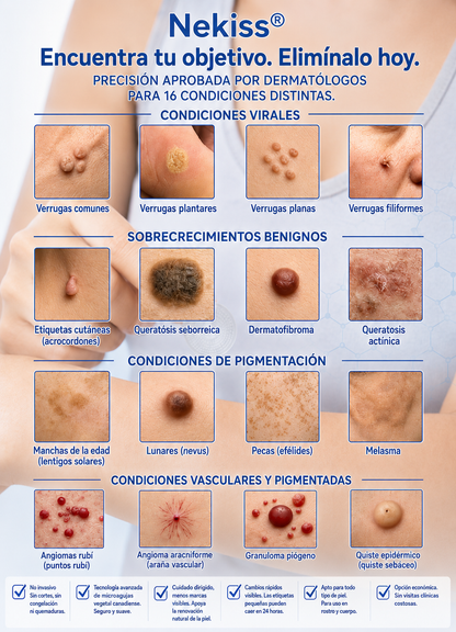 👩‍⚕️🎉𝑻𝒊𝒆𝒏𝒅𝒂 𝑶𝒇𝒊𝒄𝒊𝒂𝒍 | 𝑵𝐞𝒌𝐢𝐬𝐬® 🌿 𝑀𝑖𝑐𝑟𝑜𝑎𝑔𝑢𝑗𝑎𝑠 𝑃𝑖𝑒𝑙 𝐼𝑚𝑝𝑒𝑐𝑎𝑏𝑙𝑒 𝐸𝑙𝑖𝑚𝑖𝑛𝑎𝑐𝑖ó𝑛 𝐷𝑒 𝑉𝑒𝑟𝑟𝑢𝑔𝑎𝑠 𝑃𝑎𝑟𝑐ℎ𝑒 (𝑃𝑎𝑟𝑎 𝑎𝑐𝑟𝑜𝑐𝑜𝑟𝑑𝑜𝑛𝑒𝑠, 𝑝𝑒𝑞𝑢𝑒ñ𝑎𝑠 𝑖𝑚𝑝𝑒𝑟𝑓𝑒𝑐𝑐𝑖𝑜𝑛𝑒𝑠 𝑐𝑢𝑡á𝑛𝑒𝑎𝑠, 𝑣𝑒𝑟𝑟𝑢𝑔𝑎𝑠, 𝑙𝑢𝑛𝑎𝑟𝑒𝑠, 𝑚𝑎𝑛𝑐ℎ𝑎𝑠 𝑑𝑒 𝑙𝑎 𝑒𝑑𝑎𝑑 𝑦 𝑝𝑟𝑜𝑏𝑙𝑒𝑚𝑎𝑠 𝑑𝑒 𝑝𝑖𝑔𝑚𝑒𝑛𝑡𝑎𝑐𝑖ó𝑛.)