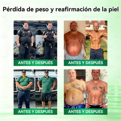✨👍𝑻𝒊𝒆𝒏𝒅𝒂 𝑶𝒇𝒊𝒄𝒊𝒂𝒍  | 👩‍⚕️ 𝑳𝒖𝒙𝒂𝒓𝒊𝒔𝒆® 10 𝑬𝑵 1 𝑴𝒐𝒓𝒊𝒏𝒈𝒂 𝒀 𝑩𝒆𝒓𝒃𝒆𝒓𝒊𝒏𝒂 𝑷𝒂𝒓𝒄𝒉𝒆 𝑨𝒗𝒂𝒏𝒛𝒂𝒅𝒐 𝑫𝒆 𝑴𝒊𝒄𝒓𝒐𝒏𝒆𝒆𝒅𝒍𝒆𝒔 𝑵𝒂𝒏𝒐（𝑼𝒏𝒂 𝒗𝒆𝒛 𝒂𝒍 𝒅í𝒂, 𝒄𝒂𝒎𝒃𝒊𝒐𝒔 𝒗𝒊𝒔𝒊𝒃𝒍𝒆𝒔 𝒆𝒏 7 𝒅í𝒂𝒔） ✅ 𝑶𝒃𝒆𝒔𝒊𝒅𝒂𝒅, 𝑫𝒊𝒂𝒃𝒆𝒕𝒆𝒔, 𝑨𝒑𝒏𝒆𝒂 𝒅𝒆𝒍 𝑺𝒖𝒆ñ𝒐 𝒚 𝑷𝒓𝒐𝒃𝒍𝒆𝒎𝒂𝒔 𝑨𝒓𝒕𝒊𝒄𝒖𝒍𝒂𝒓𝒆𝒔