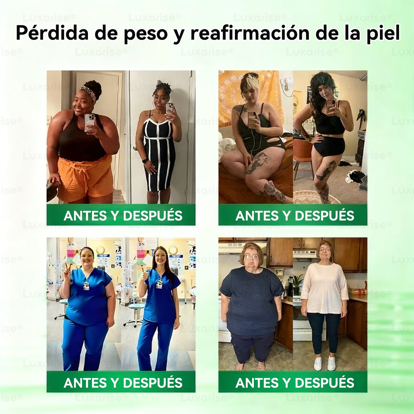 ✨👍𝑻𝒊𝒆𝒏𝒅𝒂 𝑶𝒇𝒊𝒄𝒊𝒂𝒍  | 👩‍⚕️ 𝑳𝒖𝒙𝒂𝒓𝒊𝒔𝒆® 10 𝑬𝑵 1 𝑴𝒐𝒓𝒊𝒏𝒈𝒂 𝒀 𝑩𝒆𝒓𝒃𝒆𝒓𝒊𝒏𝒂 𝑷𝒂𝒓𝒄𝒉𝒆 𝑨𝒗𝒂𝒏𝒛𝒂𝒅𝒐 𝑫𝒆 𝑴𝒊𝒄𝒓𝒐𝒏𝒆𝒆𝒅𝒍𝒆𝒔 𝑵𝒂𝒏𝒐（𝑼𝒏𝒂 𝒗𝒆𝒛 𝒂𝒍 𝒅í𝒂, 𝒄𝒂𝒎𝒃𝒊𝒐𝒔 𝒗𝒊𝒔𝒊𝒃𝒍𝒆𝒔 𝒆𝒏 7 𝒅í𝒂𝒔） ✅ 𝑶𝒃𝒆𝒔𝒊𝒅𝒂𝒅, 𝑫𝒊𝒂𝒃𝒆𝒕𝒆𝒔, 𝑨𝒑𝒏𝒆𝒂 𝒅𝒆𝒍 𝑺𝒖𝒆ñ𝒐 𝒚 𝑷𝒓𝒐𝒃𝒍𝒆𝒎𝒂𝒔 𝑨𝒓𝒕𝒊𝒄𝒖𝒍𝒂𝒓𝒆𝒔