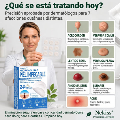 👩‍⚕️🎉𝑻𝒊𝒆𝒏𝒅𝒂 𝑶𝒇𝒊𝒄𝒊𝒂𝒍 | 𝑵𝐞𝒌𝐢𝐬𝐬® 🌿 𝑀𝑖𝑐𝑟𝑜𝑎𝑔𝑢𝑗𝑎𝑠 𝑃𝑖𝑒𝑙 𝐼𝑚𝑝𝑒𝑐𝑎𝑏𝑙𝑒 𝐸𝑙𝑖𝑚𝑖𝑛𝑎𝑐𝑖ó𝑛 𝐷𝑒 𝑉𝑒𝑟𝑟𝑢𝑔𝑎𝑠 𝑃𝑎𝑟𝑐ℎ𝑒 (𝑃𝑎𝑟𝑎 𝑎𝑐𝑟𝑜𝑐𝑜𝑟𝑑𝑜𝑛𝑒𝑠, 𝑝𝑒𝑞𝑢𝑒ñ𝑎𝑠 𝑖𝑚𝑝𝑒𝑟𝑓𝑒𝑐𝑐𝑖𝑜𝑛𝑒𝑠 𝑐𝑢𝑡á𝑛𝑒𝑎𝑠, 𝑣𝑒𝑟𝑟𝑢𝑔𝑎𝑠, 𝑙𝑢𝑛𝑎𝑟𝑒𝑠, 𝑚𝑎𝑛𝑐ℎ𝑎𝑠 𝑑𝑒 𝑙𝑎 𝑒𝑑𝑎𝑑 𝑦 𝑝𝑟𝑜𝑏𝑙𝑒𝑚𝑎𝑠 𝑑𝑒 𝑝𝑖𝑔𝑚𝑒𝑛𝑡𝑎𝑐𝑖ó𝑛.)