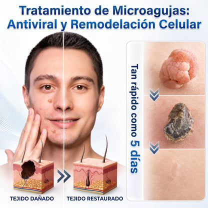 👩‍⚕️🎉𝑻𝒊𝒆𝒏𝒅𝒂 𝑶𝒇𝒊𝒄𝒊𝒂𝒍 | 𝑵𝐞𝒌𝐢𝐬𝐬® 🌿 𝑀𝑖𝑐𝑟𝑜𝑎𝑔𝑢𝑗𝑎𝑠 𝑃𝑖𝑒𝑙 𝐼𝑚𝑝𝑒𝑐𝑎𝑏𝑙𝑒 𝐸𝑙𝑖𝑚𝑖𝑛𝑎𝑐𝑖ó𝑛 𝐷𝑒 𝑉𝑒𝑟𝑟𝑢𝑔𝑎𝑠 𝑃𝑎𝑟𝑐ℎ𝑒 (𝑃𝑎𝑟𝑎 𝑎𝑐𝑟𝑜𝑐𝑜𝑟𝑑𝑜𝑛𝑒𝑠, 𝑝𝑒𝑞𝑢𝑒ñ𝑎𝑠 𝑖𝑚𝑝𝑒𝑟𝑓𝑒𝑐𝑐𝑖𝑜𝑛𝑒𝑠 𝑐𝑢𝑡á𝑛𝑒𝑎𝑠, 𝑣𝑒𝑟𝑟𝑢𝑔𝑎𝑠, 𝑙𝑢𝑛𝑎𝑟𝑒𝑠, 𝑚𝑎𝑛𝑐ℎ𝑎𝑠 𝑑𝑒 𝑙𝑎 𝑒𝑑𝑎𝑑 𝑦 𝑝𝑟𝑜𝑏𝑙𝑒𝑚𝑎𝑠 𝑑𝑒 𝑝𝑖𝑔𝑚𝑒𝑛𝑡𝑎𝑐𝑖ó𝑛.)
