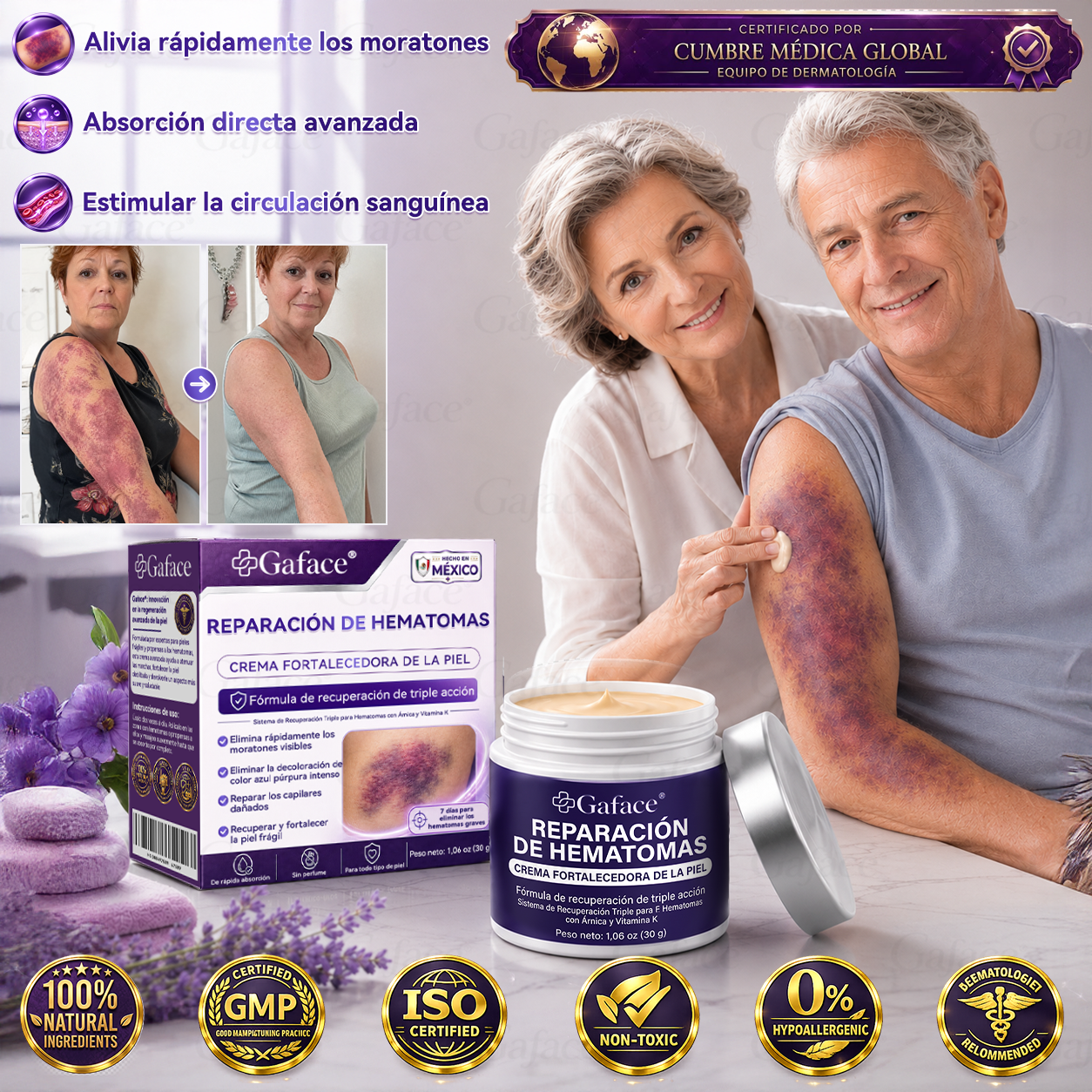 ✨👍【¡𝑴á𝒔 𝒅𝒆 110 𝒎𝒊𝒍 𝒗𝒆𝒏𝒅𝒊𝒅𝒐𝒔!】✨ 𝑮𝒂𝒇𝒂𝒄𝒆® 𝑪𝒓𝒆𝒎𝒂 𝑹𝒆𝒑𝒂𝒓𝒂𝒅𝒐𝒓𝒂 𝒅𝒆 𝑯𝒆𝒎𝒂𝒕𝒐𝒎𝒂𝒔 𝒚 𝑭𝒐𝒓𝒕𝒂𝒍𝒆𝒄𝒆𝒅𝒐𝒓𝒂 𝒅𝒆 𝒍𝒂 𝑷𝒊𝒆𝒍