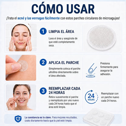 👩‍⚕️🎉𝑻𝒊𝒆𝒏𝒅𝒂 𝑶𝒇𝒊𝒄𝒊𝒂𝒍 | 𝑵𝐞𝒌𝐢𝐬𝐬® 🌿 𝑀𝑖𝑐𝑟𝑜𝑎𝑔𝑢𝑗𝑎𝑠 𝑃𝑖𝑒𝑙 𝐼𝑚𝑝𝑒𝑐𝑎𝑏𝑙𝑒 𝐸𝑙𝑖𝑚𝑖𝑛𝑎𝑐𝑖ó𝑛 𝐷𝑒 𝑉𝑒𝑟𝑟𝑢𝑔𝑎𝑠 𝑃𝑎𝑟𝑐ℎ𝑒 (𝑃𝑎𝑟𝑎 𝑎𝑐𝑟𝑜𝑐𝑜𝑟𝑑𝑜𝑛𝑒𝑠, 𝑝𝑒𝑞𝑢𝑒ñ𝑎𝑠 𝑖𝑚𝑝𝑒𝑟𝑓𝑒𝑐𝑐𝑖𝑜𝑛𝑒𝑠 𝑐𝑢𝑡á𝑛𝑒𝑎𝑠, 𝑣𝑒𝑟𝑟𝑢𝑔𝑎𝑠, 𝑙𝑢𝑛𝑎𝑟𝑒𝑠, 𝑚𝑎𝑛𝑐ℎ𝑎𝑠 𝑑𝑒 𝑙𝑎 𝑒𝑑𝑎𝑑 𝑦 𝑝𝑟𝑜𝑏𝑙𝑒𝑚𝑎𝑠 𝑑𝑒 𝑝𝑖𝑔𝑚𝑒𝑛𝑡𝑎𝑐𝑖ó𝑛.)